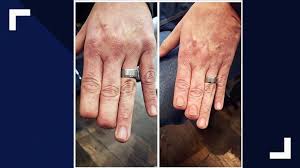 You deserve only the best! St Louis Tattoo Artist Goes Viral Helping Amputees And Women With Breast Cancer Ksdk Com