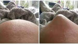 Pregnant Woman S Video Of Baby S Extreme Movements In Belly Called Extremely Unusual By Doctor Huffpost Uk Parents