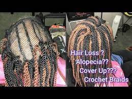 Crochet Braids On A Net With Some Alopecia Youtube Crochet Braids Crochet Braids Twist Alopecia Hairstyles