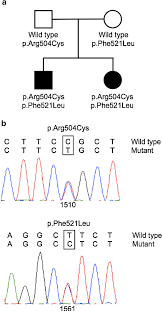 Paranoid Delusion As Lead Symptom In Two Siblings With Late Onset Tay Sachs Disease And A Novel Mutation In The Hexa Gene Semantic Scholar