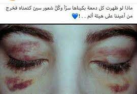 pin on صور مؤلمة