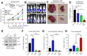 Fak Activity Sustains Intrinsic And Acquired Ovarian Cancer