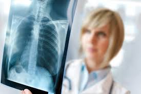 • preceding sensibilisation to microbial agent. Pneumonia Bacteriana Atlas Da Saude