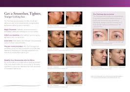 In some cases, surgery may be the only option; Thermage Procedures Can Help Smooth Tighten And Deep Contour Skin For An Overall Younger Looking Appearance Without Surgery Or Injections Thermage Skin Face