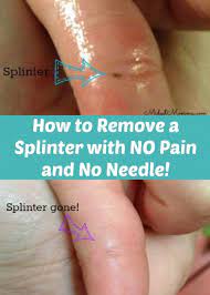 How To Remove Splinters Using Thieves Oil Essential Oils