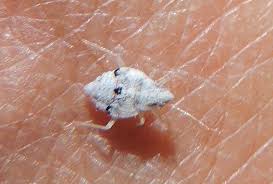 tiny white mites
