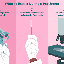 Overview Of The Pap Smear Procedure