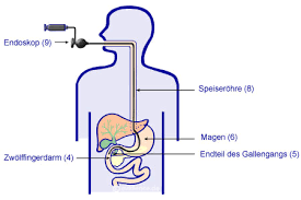 Gallensteine Cholelithiasis Gallenkolik Www Patientenleitlinien De Gesundheit Medizin Information