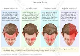 Headache Types Debbieupton Com Migraines Remedies Headache Types Natural Headache Remedies