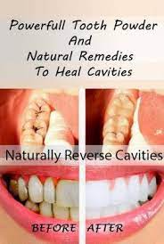 Homemade Tooth Powder That May Heal Cavities The Homestead Survival In 2021 Heal Cavities Reverse Cavities Health Remedies