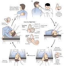 Inner Ear Crystals Epley Maneuver Positional Vertigo Get Medical Help Dr Paulose Drpaulose Physical Therapist Assistant Physical Therapy Vertigo