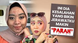 Berhenti Krim Racikan Glowing Langsung Jerawatan Bedah Tuntas Kulit Bersama Dr Mita Spkk Youtube