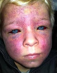 The face of a 4 year old who got stuck between two travelators : r/WTF