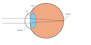 Image result for Refractive Error
