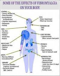 Engagiert für menschen mit fibromyalgie. I Pinimg Com 564x 7c 67 1b 7c671bdda387f4165824