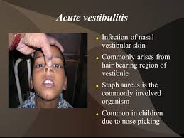It may be secondary to chronic rhinorrhea, nose picking or viral infections. Conditions Involving External Nose Dr T Balasubramanian Ppt Download