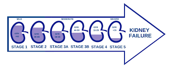Stages Of Kidney Disease Dallas Nephrology Associates