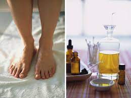 How To Use Tea Tree Oil For Treating Toe Nail Fungus Toenail Fungus Remedies Toenail Fungus Tea Tree Oil For Acne