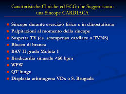 Sincopa este o pierdere temporara a cunostintei, cauzata de fluxul sanguin insuficient catre creier. Definizione Sincope Task Force Esc Ppt Scaricare