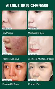 Ellen Ella Cica-ReBalance Essence Toner 80ml