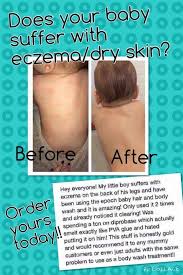 Epoch Baby Hibiscus Hair And Body Wash Indigenous Parents Have Long Used Special Flowers And Plants To Cleanse Their Babies Epoch Bab Nuskin Young Skin Body