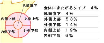 「乳がん」の画像検索結果