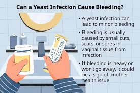 Can a Yeast Infection Cause Bleeding?