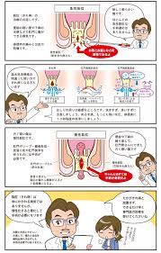 保存的加療編 神戸の肛門科 みつみや大腸肛門クリニック クリニック 大腸 神戸