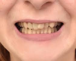 From the moment i walked in, i was treated like i'd. Waldorf Dental Group Dentist Waldorf Md