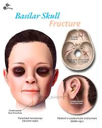 Edison edison woods (jessysajikwt)