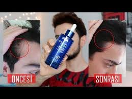 1700 Sac Teli Cikaran Tonik Denser Hair Aras Barlas Youtube Tonik Youtube Cilt Bakimi