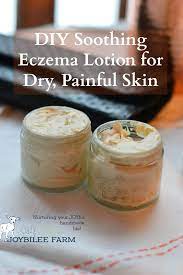 Are you looking for the best baby washes or shampoos to get rid of baby eczema? Diy Eczema Cream Joybilee Farm Diy Herbs Gardening