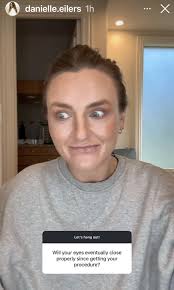 Eyelids : r/DanielleEilersSnark