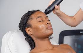 Contact 3 — Embrace Esthetics