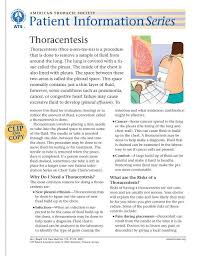 Image result for Thoracentesis