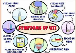 Collecting urine to exclude uti is not required if there is another clear focus of fever and the child is not unwell. Urinary Tract Infections In Children
