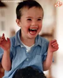 A father with Down syndrome raised his son who is now a doctor!🥹❤️