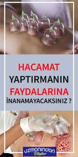 Hacamatin Faydalari Nelerdir Natural Health Remedies Health Remedies Health
