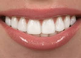 Cosmetic Dentistry Tappan Teeth Whitening Porcelain Veneers