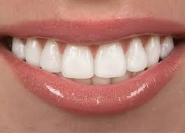 cosmetic dentistry tappan teeth whitening porcelain veneers