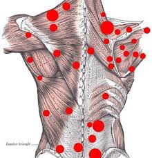 Trigger points (or myofascial trigger points) are one of the most painful and lingering conditions resulting from myofascial pain syndrome (mps). Basics Of Trigger Point Therapy In Phoenix Az Pain And Spine Clinics
