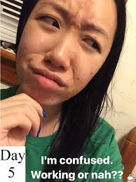 Dùng thử toner giấm táo trị mụn “thần thánh”, cô nàng này đã rút ra kết  luận đau thương