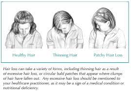 This means that it can help prevent the hair loss that is naturally associated with the male hormone. Lack Of Estrogen Cause Hair Loss