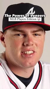 Congratulations To The @dodgers On Their #worldseries Win! ⚾️⚾️⚾️ Veneers  Make Everything Better 😬😬 : It’s Spooky Season Over At My Scottsdale  Dentist 🧛🏻‍♂️🧛🏻‍♂️🎃🎃 Come See Us For A Spooktacular Time! ...