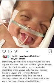Fetty wap's daughter alaiya appears in photo after premature birth. No Matter Her Disabilities I Ll Always Be By Her Side Alexis Sky Speaks About Having A Differently Abled Child