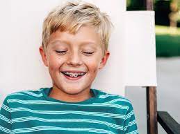 Whiten your teeth with snow® & start smiling again. Teeth Whitening With Braces Best Options