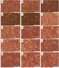 Image result for Dicoma anomala