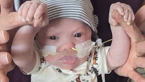 Fundraiser by johanna Laykoff : Help Vaughn Thrive: A Call for Support