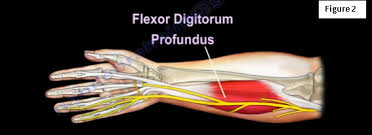 From there, fds and fdp send individual tendons to the index, long, ring, and small fingers. Ulnar Claw Hand Ulnar Claw Hand Is An Abnormal Hand By Nabil Ebraheim Thrive Global Medium