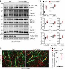 Lysosome and lysosomal trafficking defects in the cerebellum of aged...